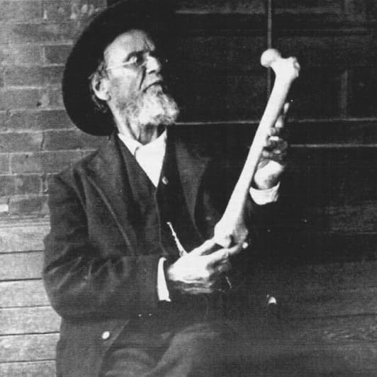 A.T. Still holding a femur